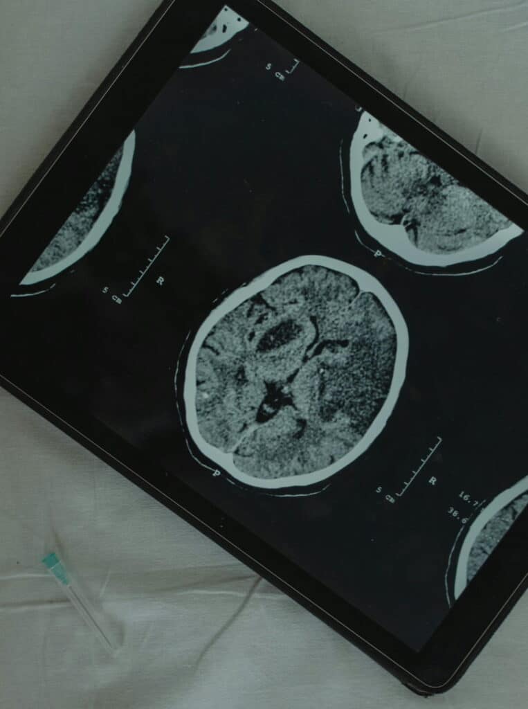 LAS NEURONAS
