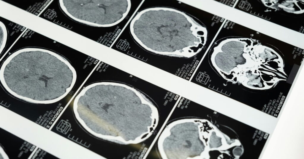 LAS NEURONAS