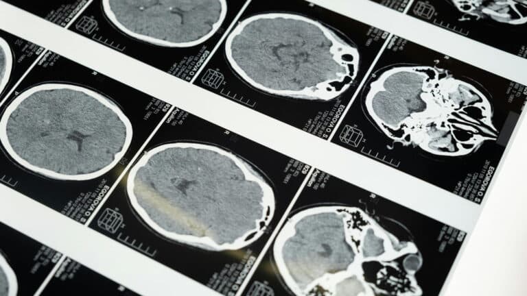 LAS NEURONAS