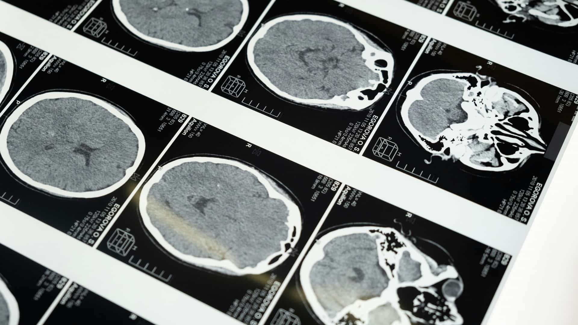 LAS NEURONAS
