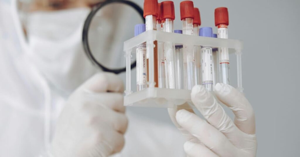 Análisis de sangre esclerosis múltiple