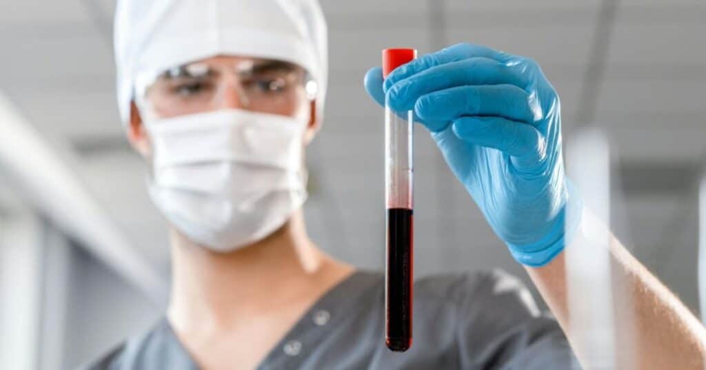 Análisis de sangre esclerosis múltiple