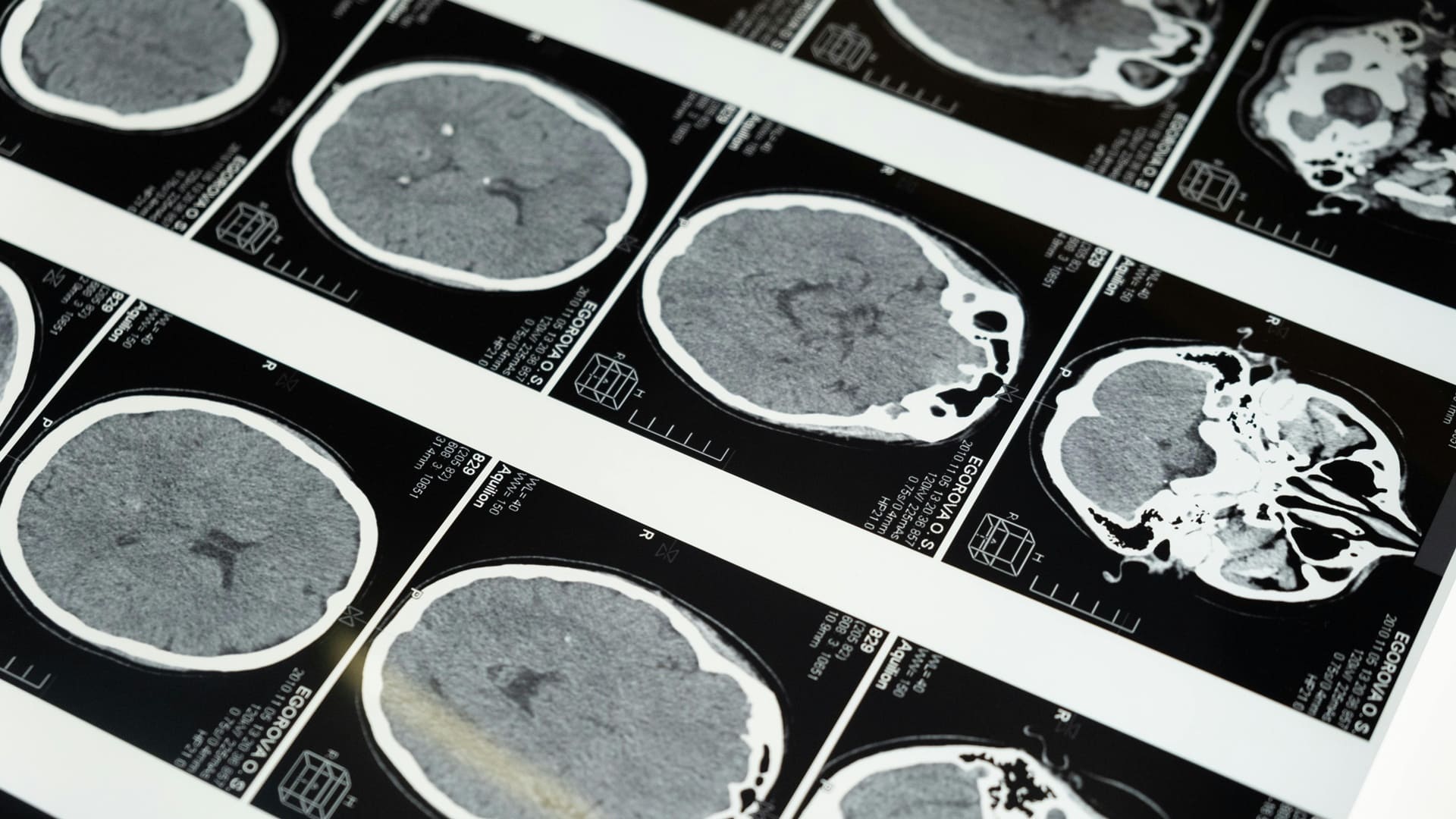 Avances en enurociencia