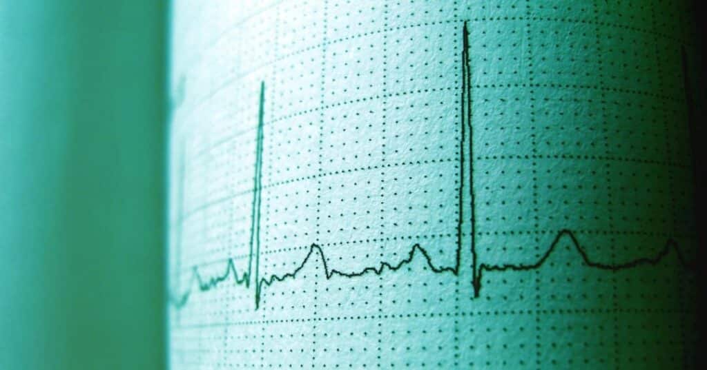 Cirugia de epilepsia Panama 8