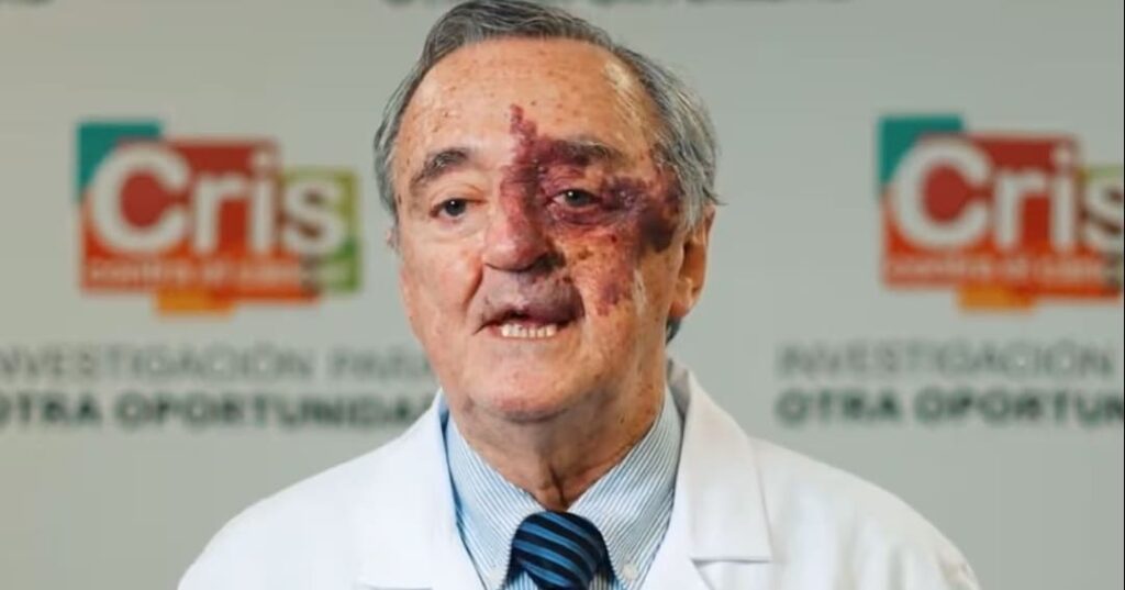 Cura del cáncer de páncreas