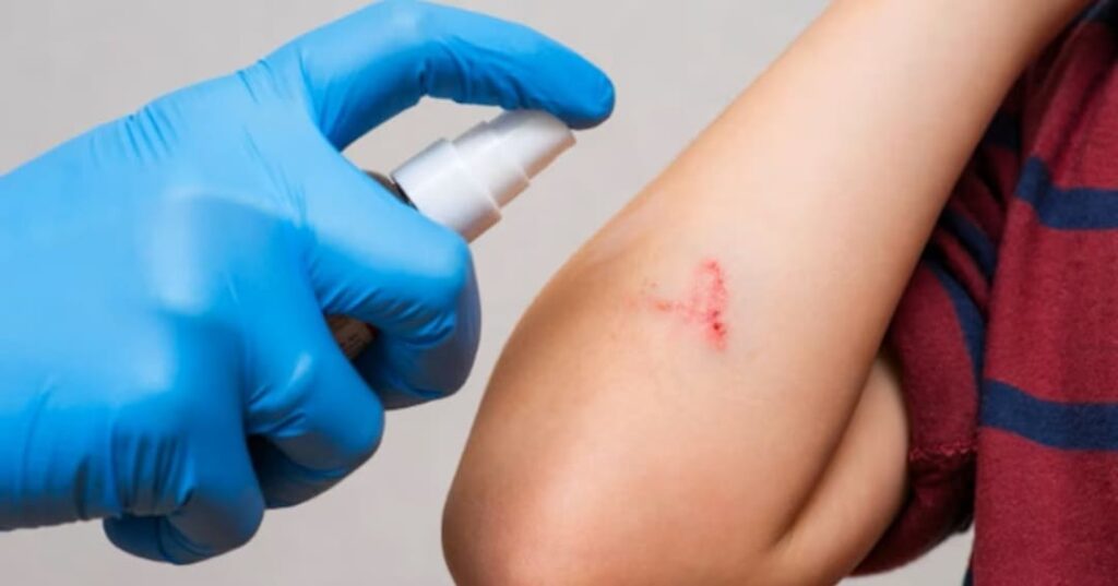 agente hemostático en polvo ultrarrápido para hemorragias