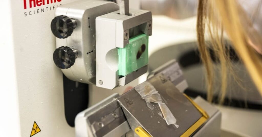 córnea artificial a base de escamas de peces