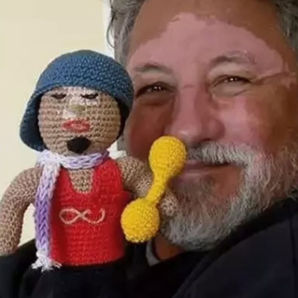 muñecas de ganchillo con vitiligo