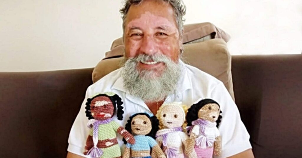 muñecas de ganchillo con vitiligo