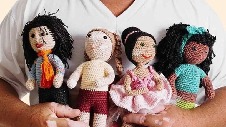 muñecas de ganchillo con vitiligo