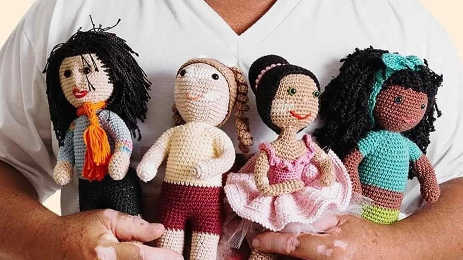 muñecas de ganchillo con vitiligo