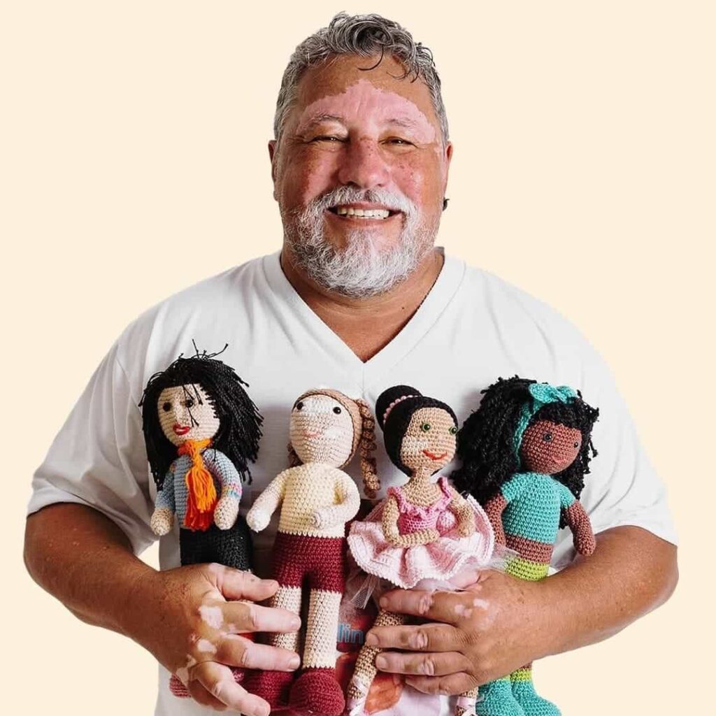 muñecas de ganchillo con vitiligo
