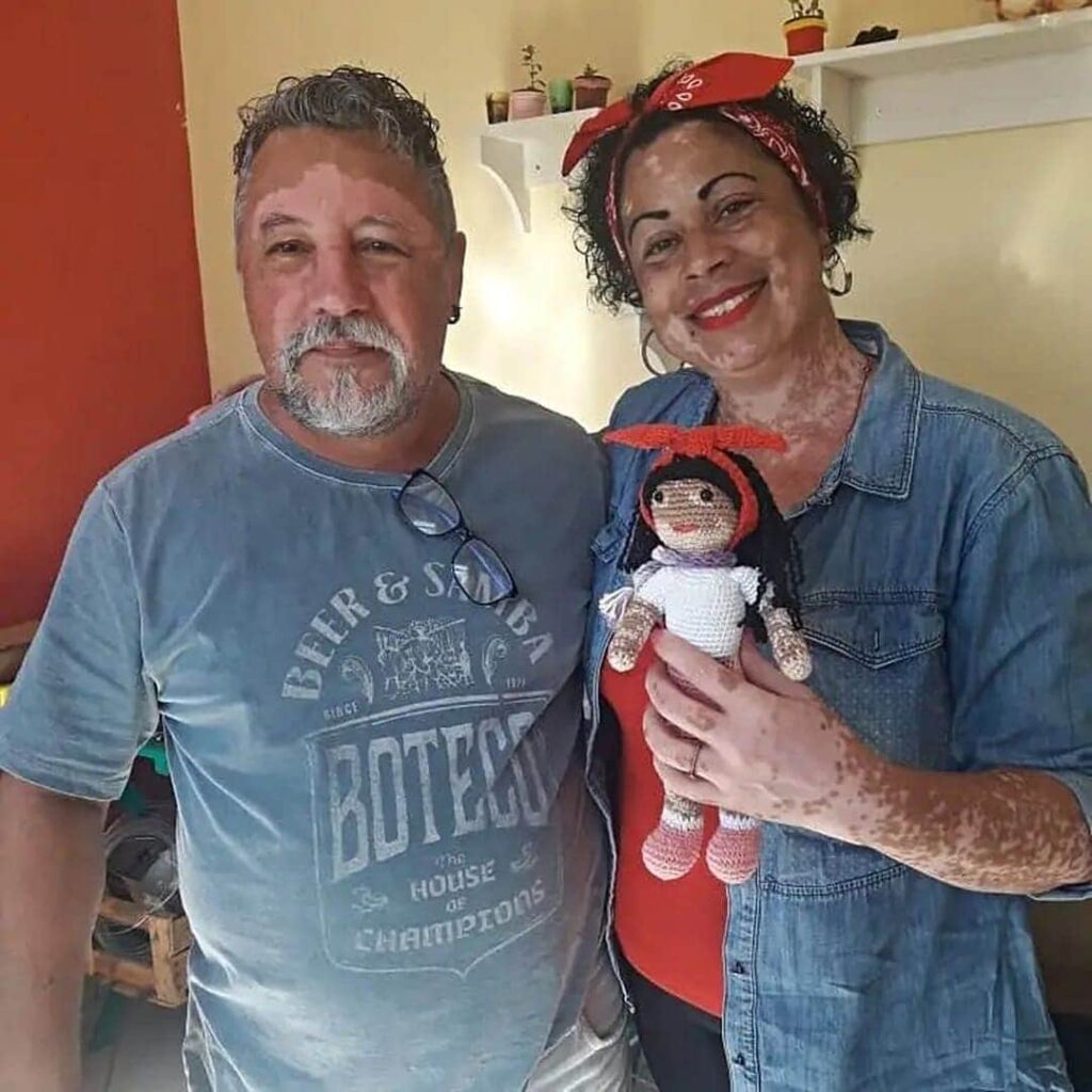 muñecas de ganchillo con vitiligo