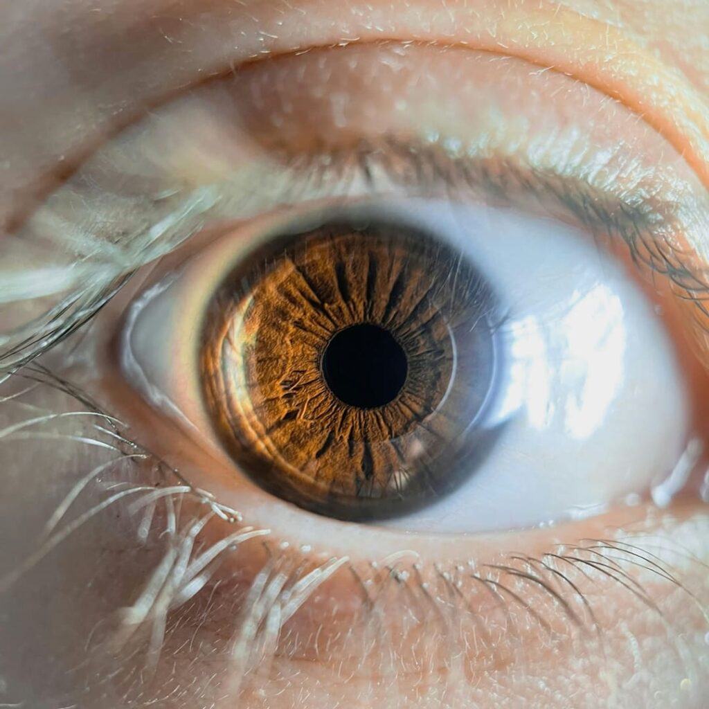 lentes de contacto inteligentes para detectar cáncer