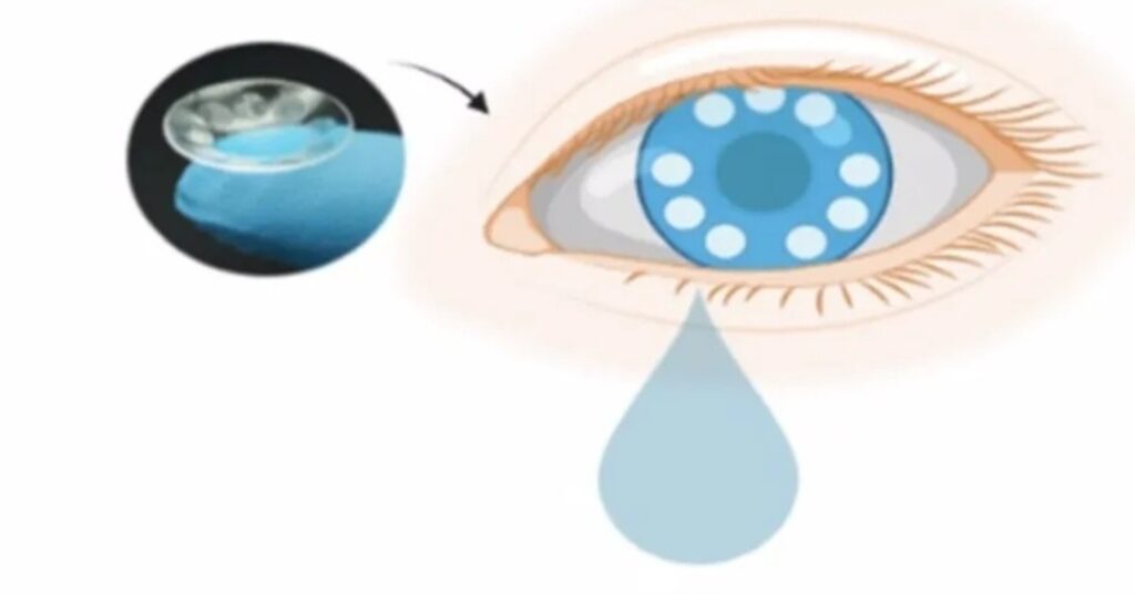 lentes de contacto inteligentes para detectar cáncer