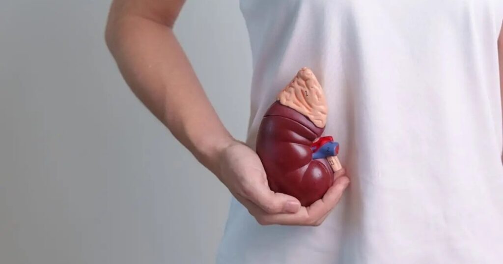 CDH1 como marcador de inmunoterapia en cáncer renal