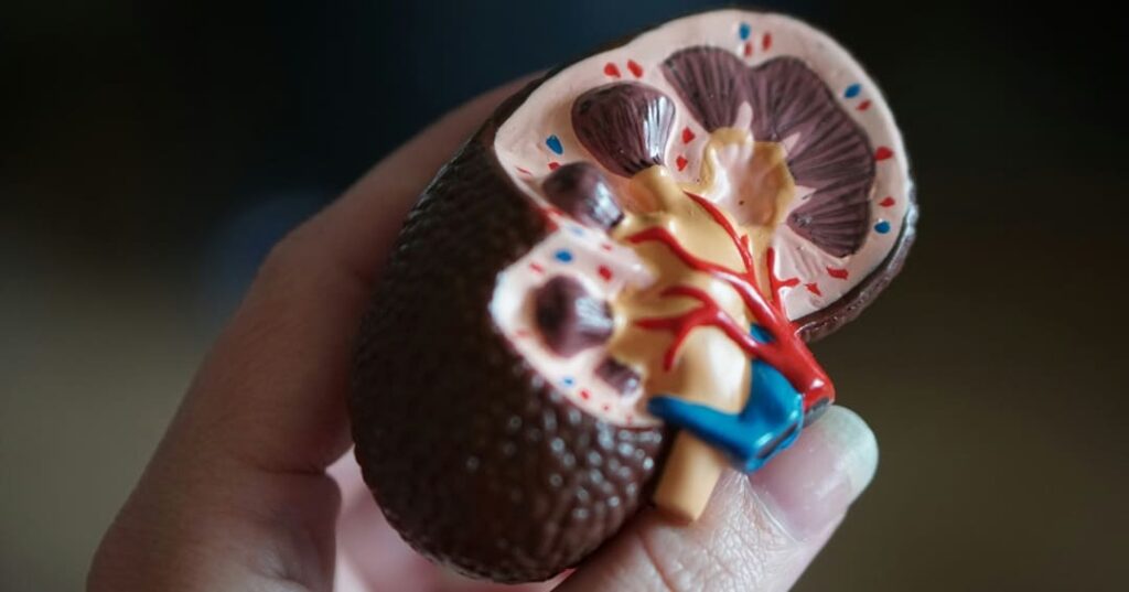 CDH1 como marcador de inmunoterapia en cáncer renal