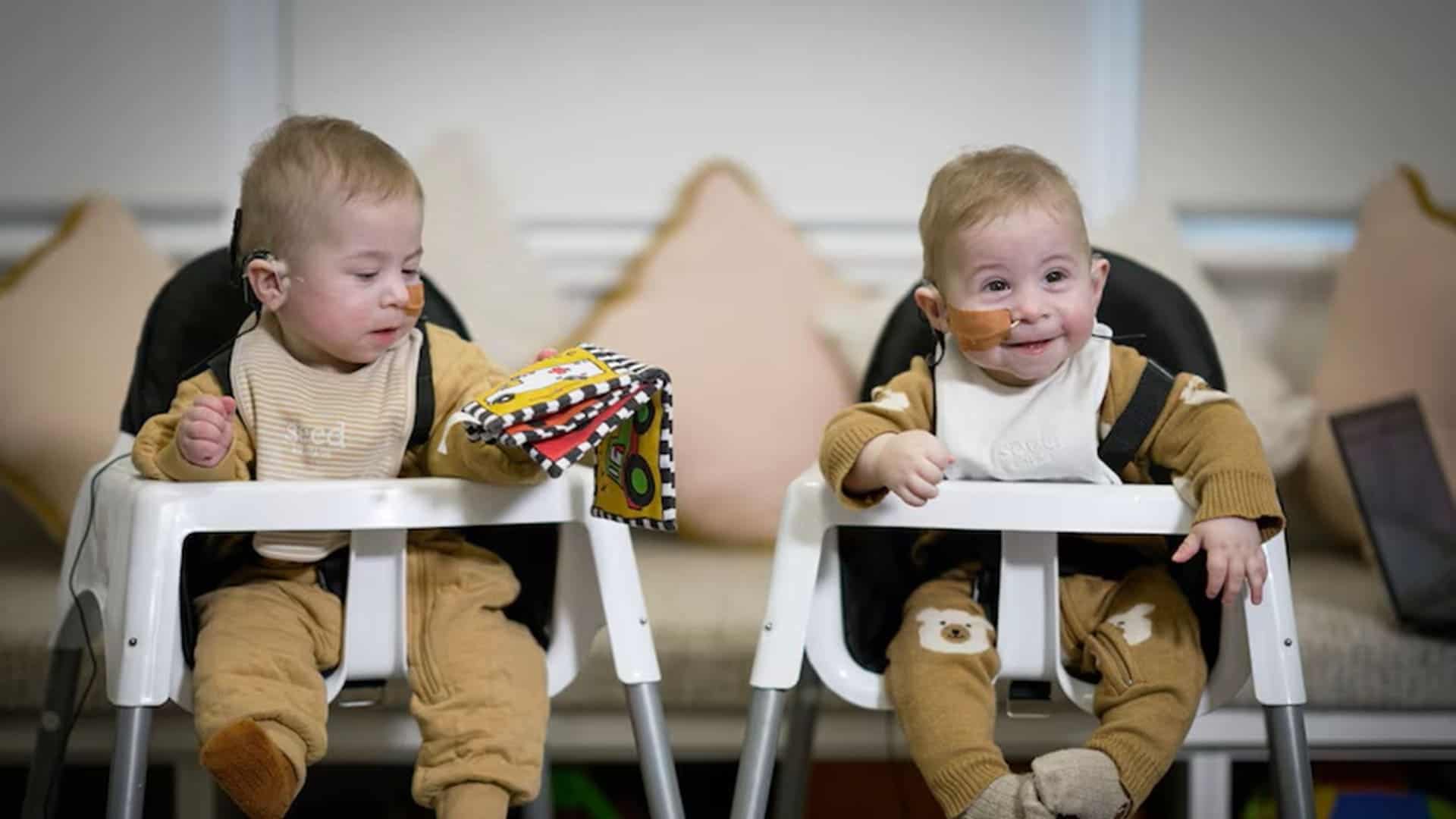 gemelos australianos sordos