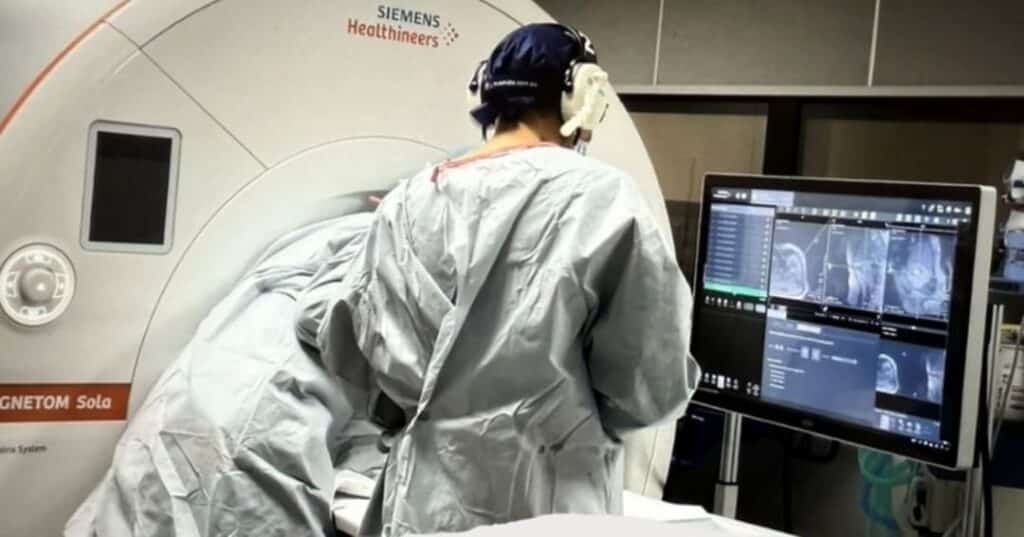 máquina MRI que congela tumores sin cirugía invasiva