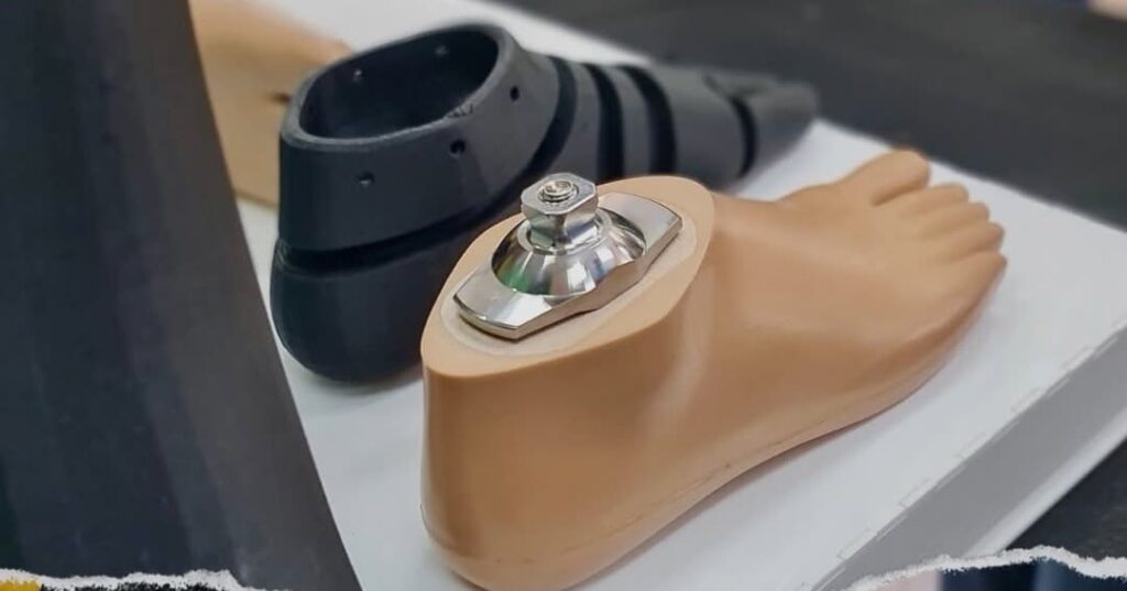Panamá apuesta por prótesis 3D para devolver sonrisas 3 prótesis hecha con tecnología de impresión 3D