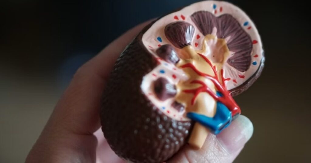 La proteína que podría revolucionar el tratamiento de los riñones dañados 6 proteína IL-11 puede reducir la fibrosis y regenerar riñones