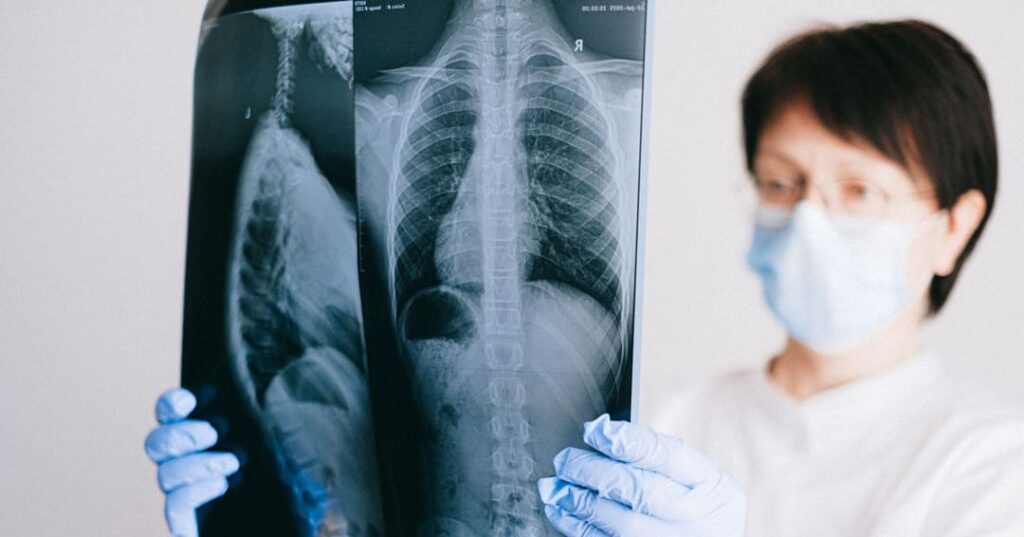 fármacos frenan el crecimiento del cáncer de pulmón