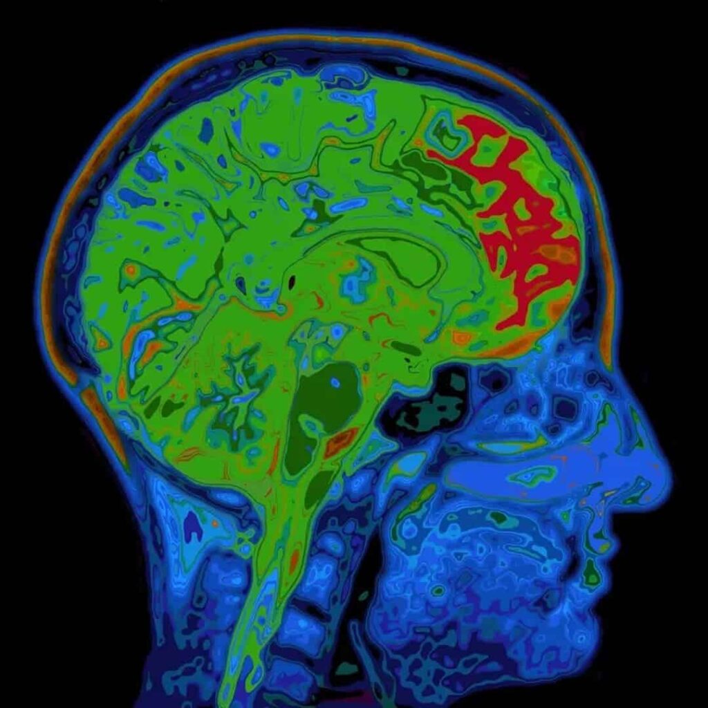 acupuntura modifica la estructura funcional del cerebro