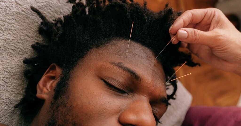 acupuntura modifica la estructura funcional del cerebro