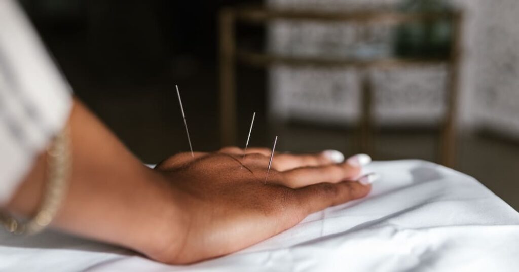 acupuntura modifica la estructura funcional del cerebro