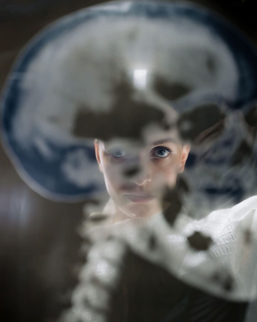 acupuntura modifica la estructura funcional del cerebro
