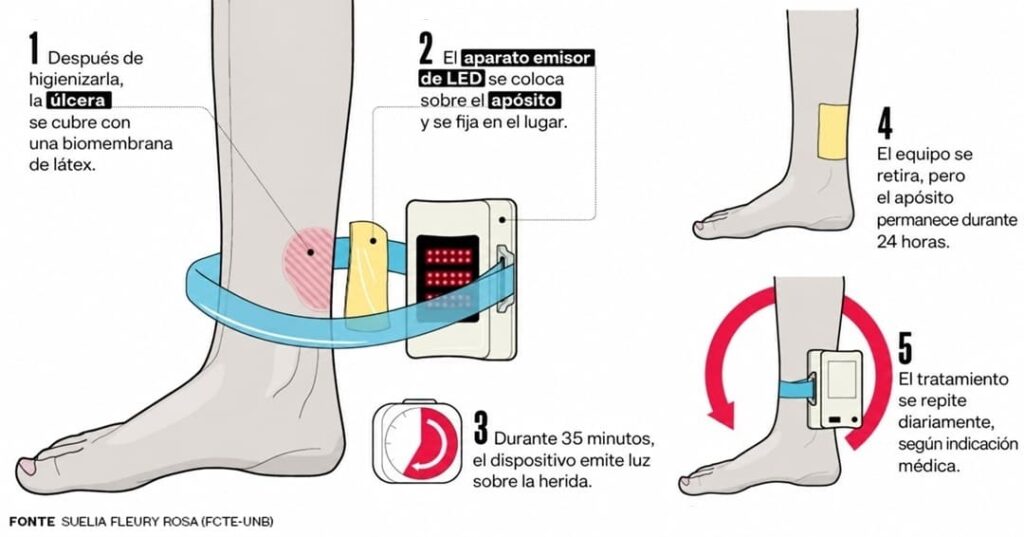 RAPHA: 20 años de ciencia contra el pie diabético en Brasil 8 tecnología brasileña RAPHA