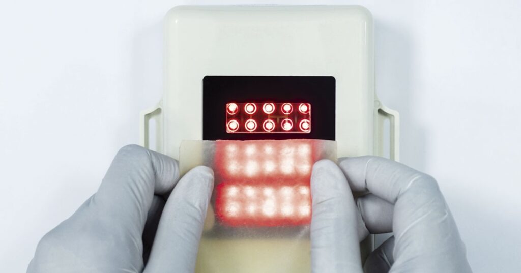 RAPHA: 20 años de ciencia contra el pie diabético en Brasil 4 tecnología brasileña RAPHA