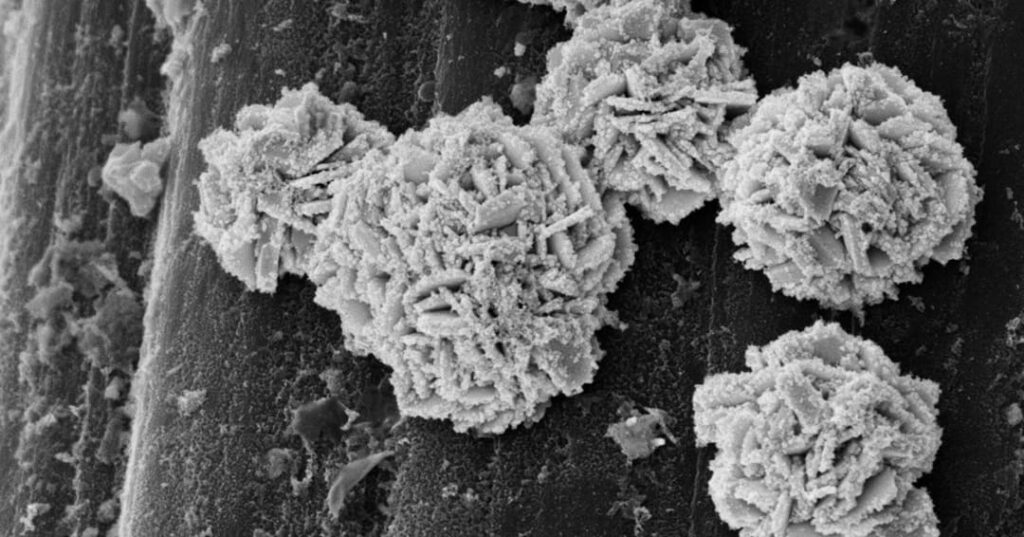 El implante que convierte glucosa: un nuevo camino contra la diabetes 4 implante electrónico de ETH Zurich